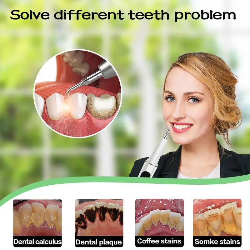 Ultraschall-Zahnreiniger — sanfte Tiefenreinigung für strahlendes Lächeln Mivoza Deutschland