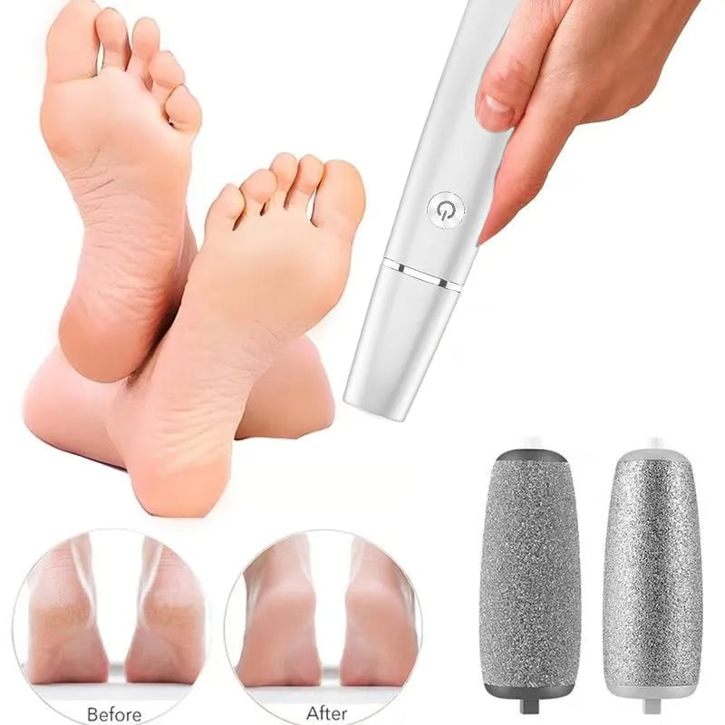 Electric Foot Smoother — Silky Smooth Skin Every Day